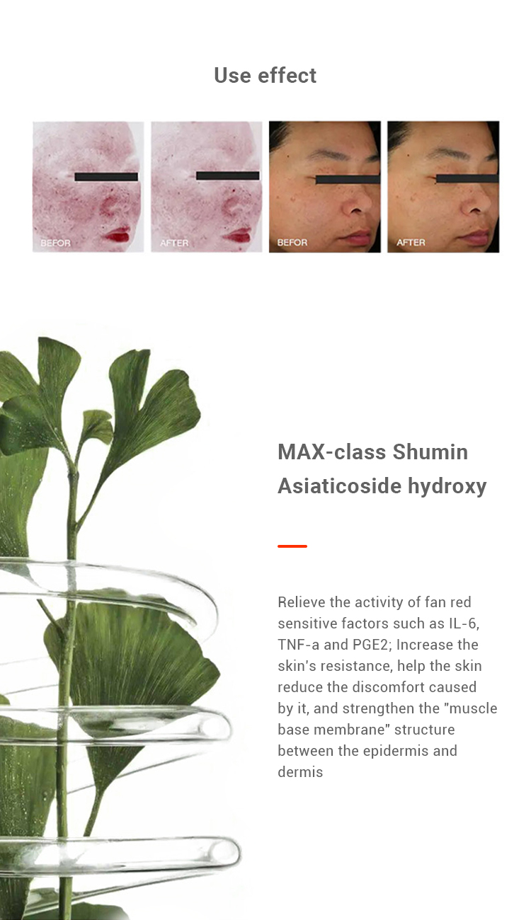 max-class shumin asiaticoside hydroxy